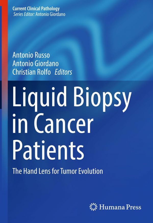 Liquid Biopsy In Cancer Patients The Hand Lens For Tumor Evolution Antonio Giordano
