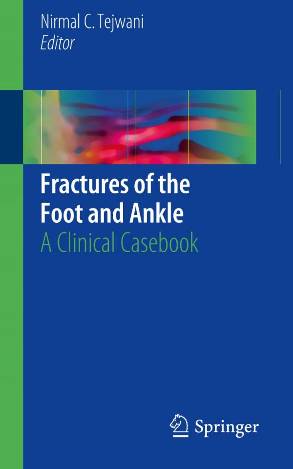 Fractures Of The Foot And Ankle A Clinical Casebook Tejwani