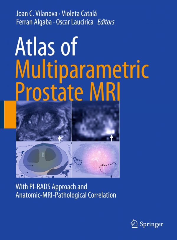 Atlas Of Multiparametric Prostate Mri With Pirads Approach And Anatomicmripathological Correlation Algaba