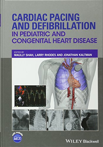 Cardiac Pacing And Defibrillation In Pediatric And Congenital Heart Disease 1st Edition Maully Shah