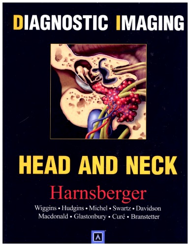 Diagnostic Imaging Head And Neck Ric Harnsberger Et Al