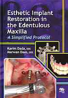 Esthetic Implant Restoration In The Edentulous Maxilla A Simplified Protocol Daas