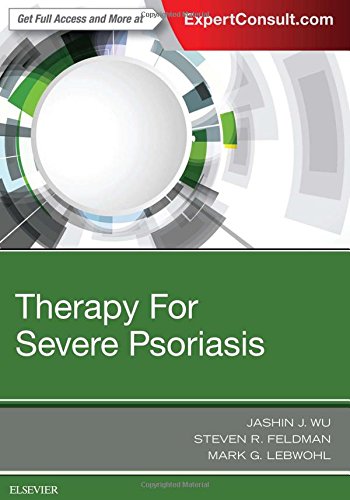 Therapy For Severe Psoriasis 1st Jashin J Wu Steven R Feldman