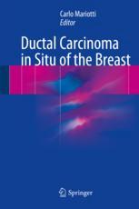 Ductal Carcinoma In Situ Of The Breast 1st Edition Carlo Mariotti Eds