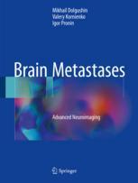 Brain Metastases Advanced Neuroimaging 1st Edition Mikhail Dolgushin