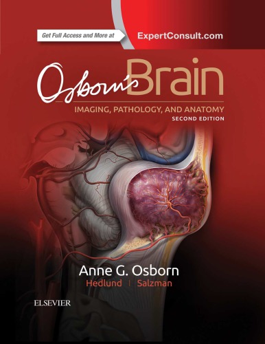 Osborns Brain Imaging Pathology And Anatomy 2nd Anne G Osborn