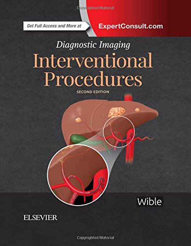 Interventional Procedures 2nd Brandt C Wible