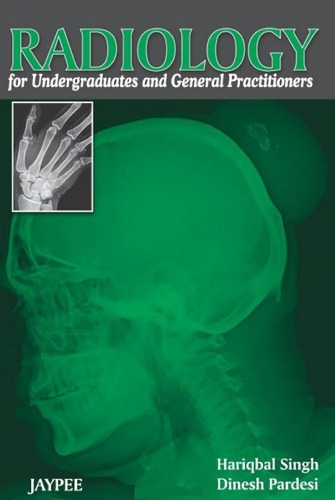 Radiology For Undergraduates And General Practitioners 1st Edition Hariqbal
