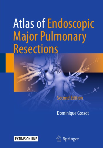Atlas Of Endoscopic Major Pulmonary Resections 2nd Edition Dominique Gossot
