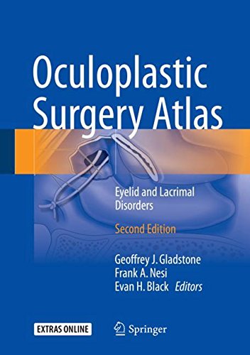Oculoplastic Surgery Atlas Eyelid And Lacrimal Disorders 2nd Ed 2018 Geoffrey J Gladstone