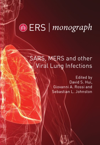 Sars Mers And Other Viral Lung Infections David S Hui Giovanni A Rossi