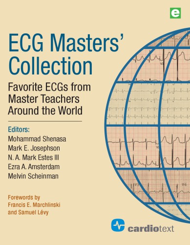 Ecg Masters Collection Favorite Ecgs From Master Teachers Around The World Mohammad Shenasa Et Al Eds