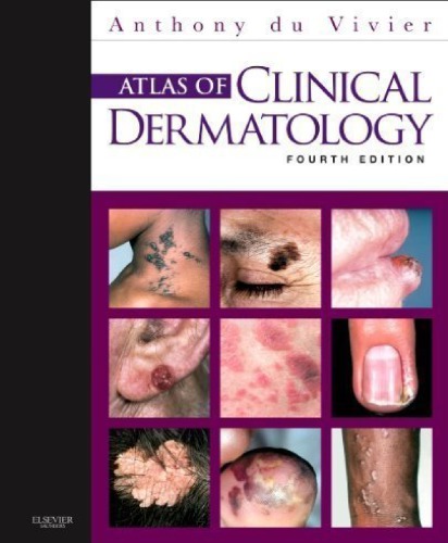 Atlas Of Clinical Dermatology 4th Anthony Du Vivier