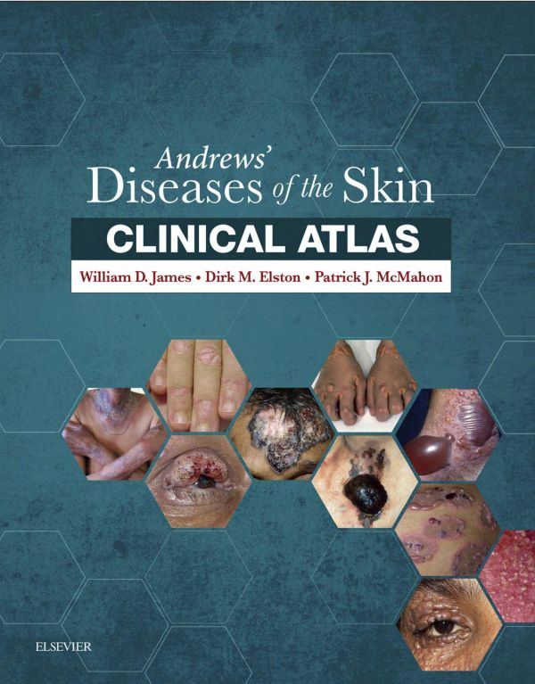 Andrews Diseases Of The Skin Clinical Atlas 1st William D James