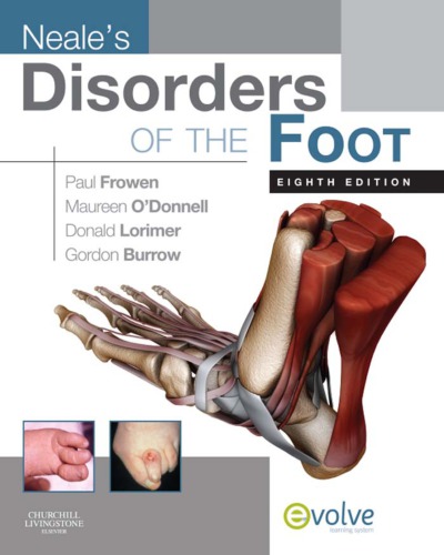 Neales Disorders Of The Foot 8th Paul Frowen Maureen Odonnell