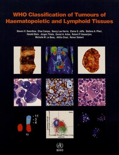 Who Classification Of Tumours Of Haematopoietic And Lymphoid Tissues 4th S Swerdlow