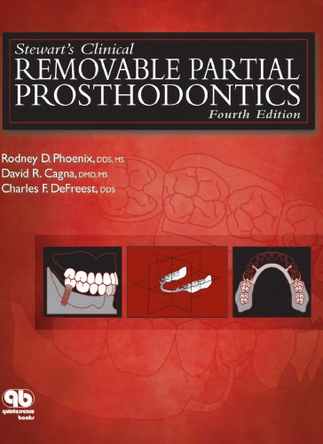 Stewarts Clinical Removable Partial Prosthodontics 4th Rodney D Phoenix