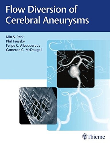Flow Diversion Of Cerebral Aneurysms 1st Edition Min S Park
