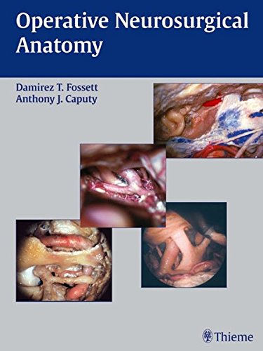 Operative Neurosurgical Anatomy Damirez Fossett