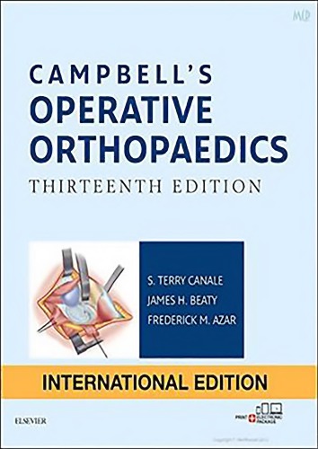 Campbells Operative Orthopaedics 13th Edition Frederick M Azar