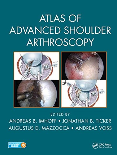 Atlas Of Advanced Shoulder Arthroscopy 1st Edition Andreas B Imhoff