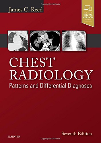Chest Radiology Patterns And Differential Diagnoses 7e Seventh Edition Reed