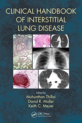 Clinical Handbook Of Interstitial Lung Disease 1st Edition Muhunthan Thillai