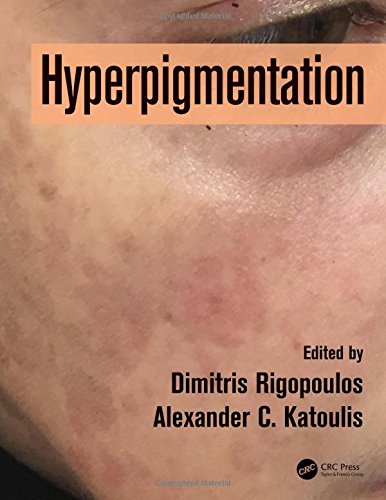 Hyperpigmentation 1st Edition Dimitris Rigopoulos Alexander C Katoulis