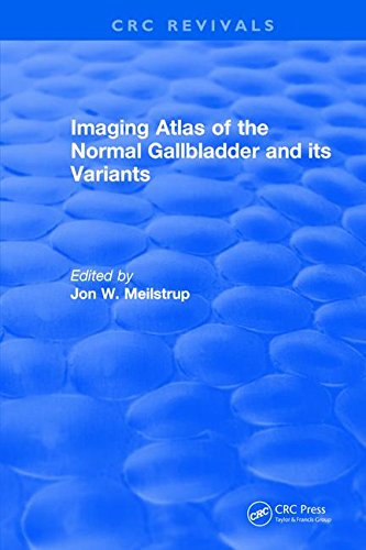 Imaging Atlas Of The Normal Gallbladder And Its Variants Jw Meilstrup