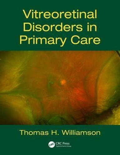 Vitreoretinal Disorders In Primary Care 1st Edition Thomas H Williamson