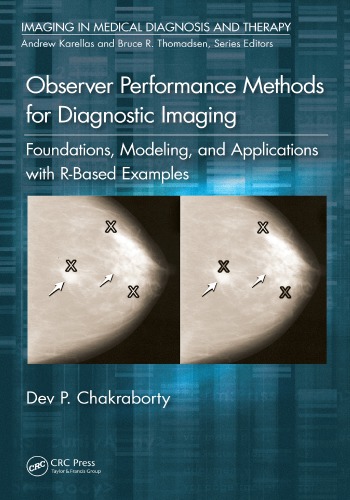 Observer Performance Methods For Diagnostic Imaging Foundations Modeling And Applications With Rbased Examples Chakraborty