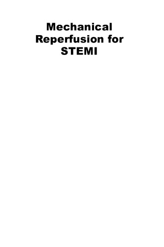 Mechanical Reperfusion For Stemi From Randomized Trials To Clinical Practice De Luca