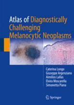 Atlas Of Diagnostically Challenging Melanocytic Neoplasms 1st Edition Caterina Longo
