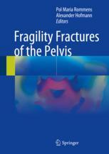 Fragility Fractures Of The Pelvis 1st Edition Pol Maria Rommens