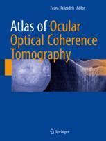 Atlas Of Ocular Optical Coherence Tomography 1st Edition Fedra Hajizadeh Eds