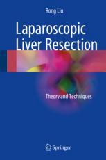 Laparoscopic Liver Resection Theory And Techniques 1st Edition Rong Liu Auth