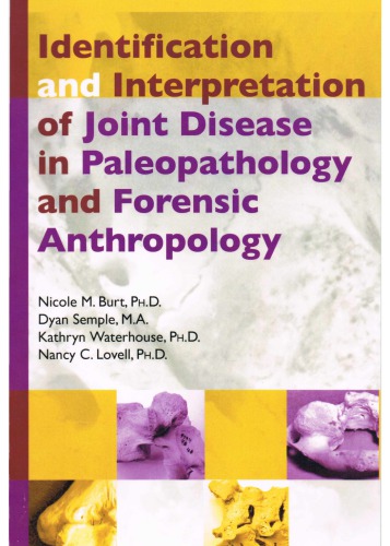 Identification And Interpretation Of Joint Disease In Paleopathology And Forensic Anthropology Nicole M Burt
