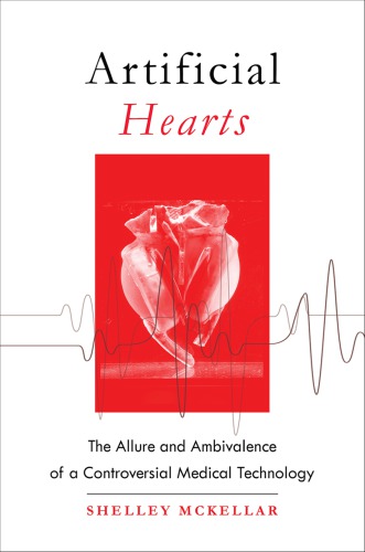 Artificial Hearts The Allure And Ambivalence Of A Controversial Medical Technology Shelley Mckellar