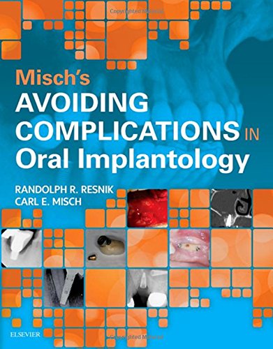 Mischs Avoiding Complications In Oral Implantology 1st Randolph Resnik