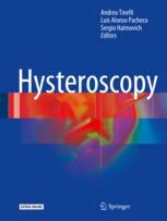 Hysteroscopy 1st Edition Andrea Tinelli Luis Alonso Pacheco Sergio Haimovich