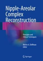 Nippleareolar Complex Reconstruction Principles And Clinical Techniques 1st Edition Melvin A Shiffman Eds