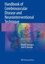 Handbook Of Cerebrovascular Disease And Neurointerventional Technique 3rd Edition Mark R Harrigan