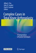 Complex Cases In Total Knee Arthroplasty A Compendium Of Current Techniques 1st Edition Alfred J Tria