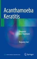 Acanthamoeba Keratitis Diagnosis And Treatment 1st Edition Xuguang Sun Auth