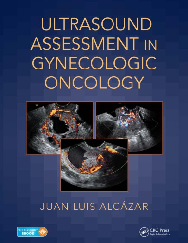 Ultrasound Assessment In Gynecologic Oncology Alczar Juan Luis