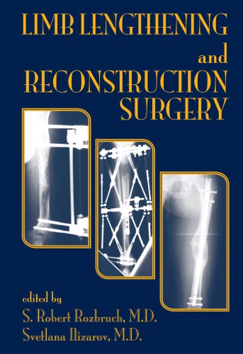 Limb Lengthening And Reconstruction Surgery Rozbruch S Robert