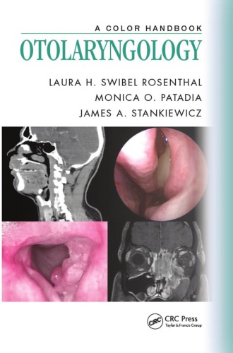 A Color Handbook Otolaryngology Patadia Monica O Rosenthal