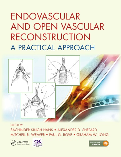 Endovascular And Open Vascular Reconstruction A Practical Approach First Edition Hans