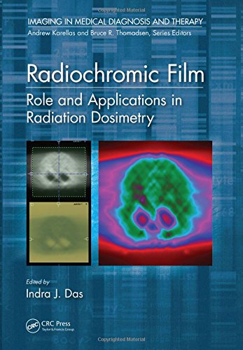 Radiochromic Film Role And Applications In Radiation Dosimetry 1st Edition Indra J Das