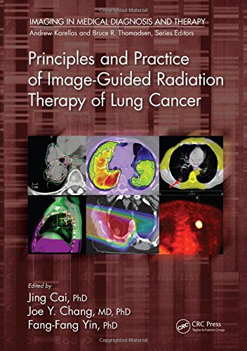 Principles And Practice Of Imageguided Radiation Therapy Of Lung Cancer 1st Edition Jing Cai
